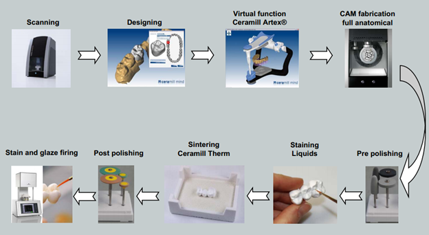 Giới thiệu về răng sứ Ceramill Zolid