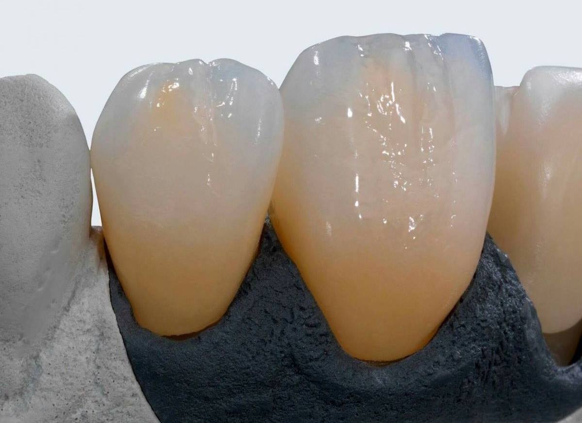 SỨ CERAMILL ZOLID LÀ GÌ